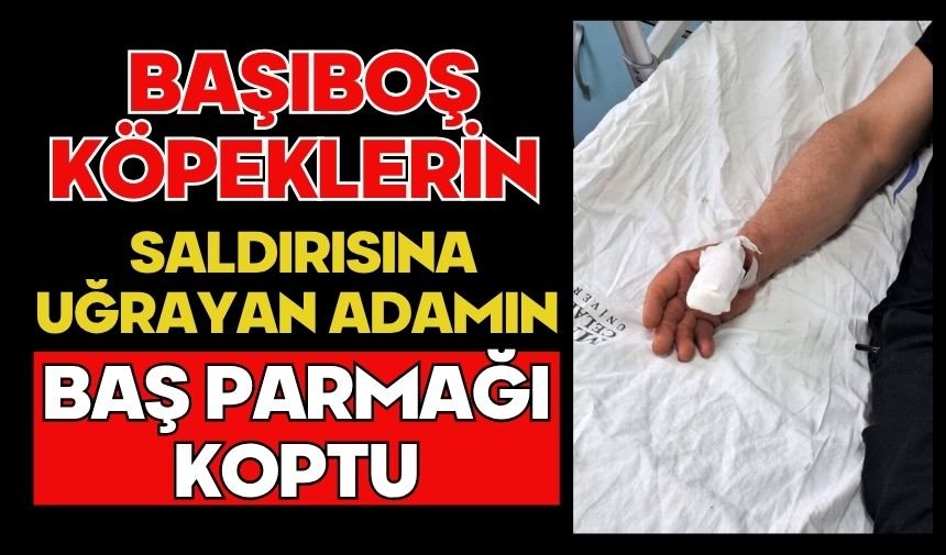 Başıboş köpeklerin saldırısına uğrayan adamın baş parmağı koptu