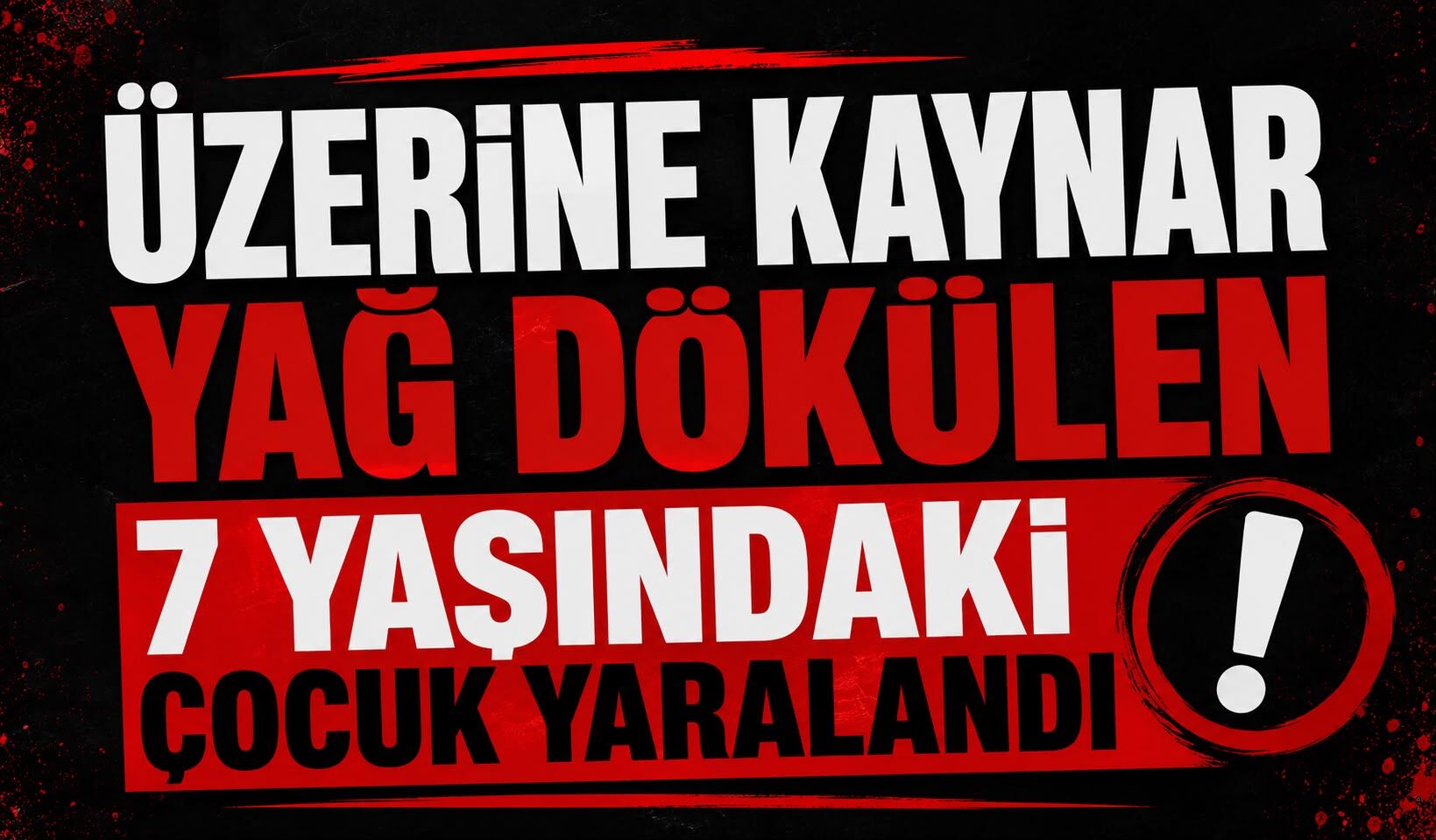 Üzerine kaynar yağ dökülen 7 yaşındaki çocuk yaralandı