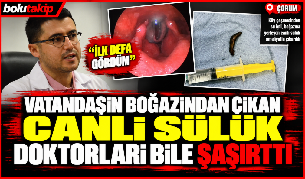 Vatandaşın boğazından çıkan canlı sülük doktorları bile şaşırttı: "İlk defa gördüm"