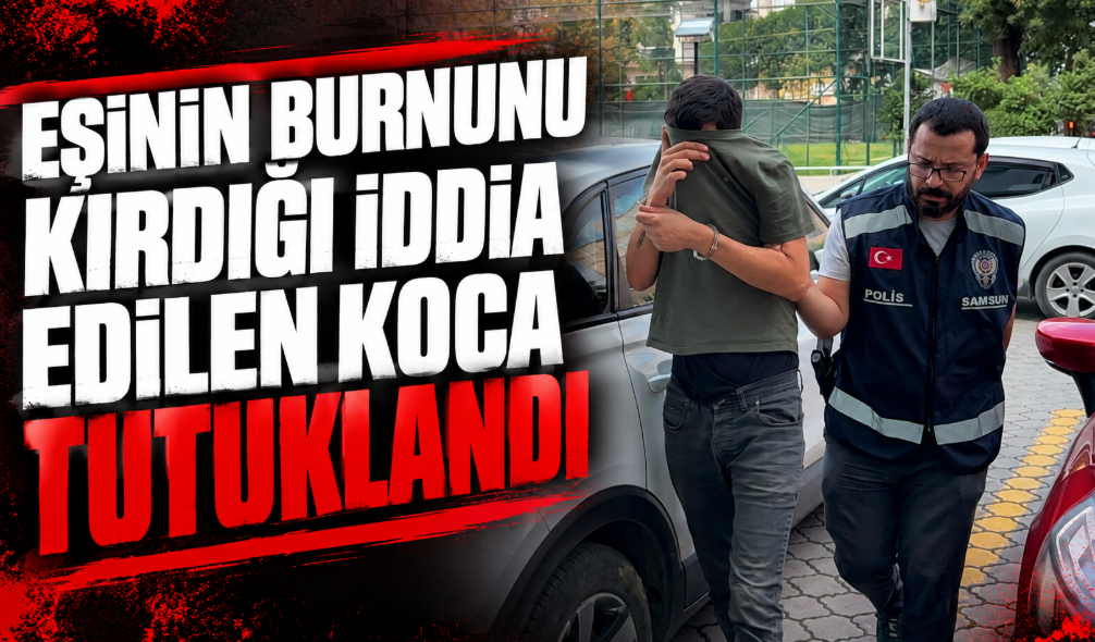 Eşinin burnunu kırdığı iddia edilen koca tutuklandı