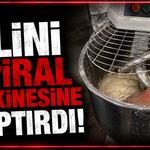 Elini spiral makinesine kaptırdı