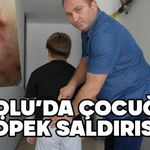 Bolu'da çocuğa köpek saldırısı