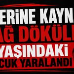 Üzerine kaynar yağ dökülen 7 yaşındaki çocuk yaralandı
