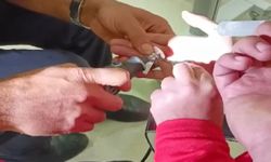Yüzüğe sıkışan parmağı itfaiye ekipleri kurtardı