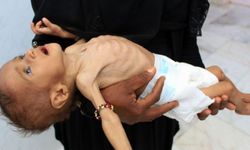 Yemen krizi: '85 bin çocuk açlıktan öldü'