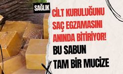 Cilt kuruluğunu, saç egzamasını anında bitiriyor! Bu sabun tam bir mucize