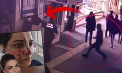 Yüzüne 40 dikiş atıldı, dehşet anlarını anlattı! Marmaray'daki kadın görevliye bıçaklı saldırı