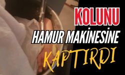 Kolunu hamur makinesine kaptırdı