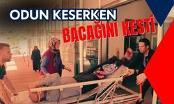 Odun keserken bacağını kesti