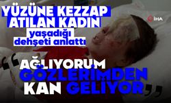 Yüzüne kezzap atılan kadın yaşadığı dehşeti anlattı