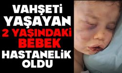 Vahşeti yaşayan 2 yaşındaki bebek hastanelik oldu