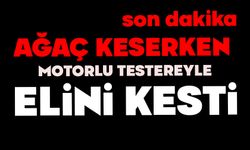 Ağaç keserken motorlu testere ile elini kesti
