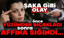 Önce yüzünden bıçakladı ardından 'Affına sığınıyorum' mesajı attı