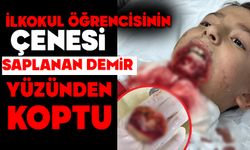 İlkokul öğrencisinin çenesi saplanan demir yüzünden koptu
