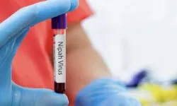 Nipah virüsü yayılıyor mu