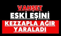 Vahşet: Eski eşini kezzapla ağır yaraladı