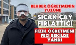 Rehber öğretmenin yüzüne sıcak çay fırlattığı fizik öğretmeni feci şekilde yandı