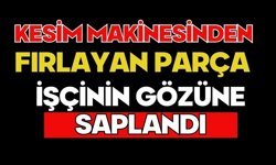 Kesim makinesinden fırlayan parça işçinin gözüne saplandı