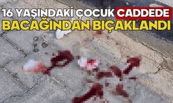 16 yaşındaki çocuk caddede bacağından bıçaklandı