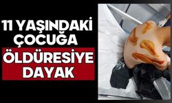 11 yaşındaki çocuğa öldüresiye dayak
