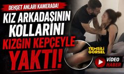 Kız arkadaşının kollarını kızgın kepçeyle yaktı
