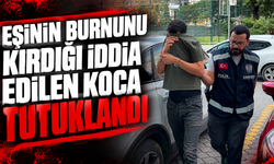 Eşinin burnunu kırdığı iddia edilen koca tutuklandı