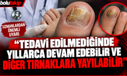 "Tedavi edilmediğinde yıllarca devam edebilir ve diğer tırnaklara yayılabilir"