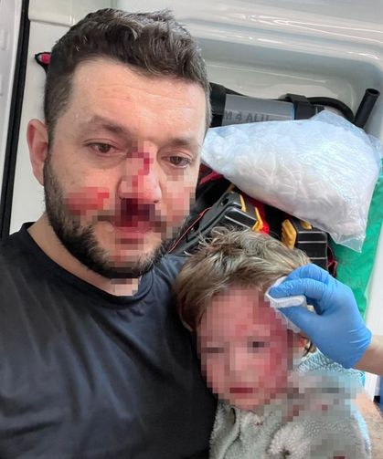 Yalova'da komşuların gürültü kavgasında 14 aylık bebek hastanelik oldu