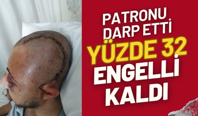 Patronunun öldüresiyle darp ettiği çalışan yüzde 32 fiziksel engelli kaldı