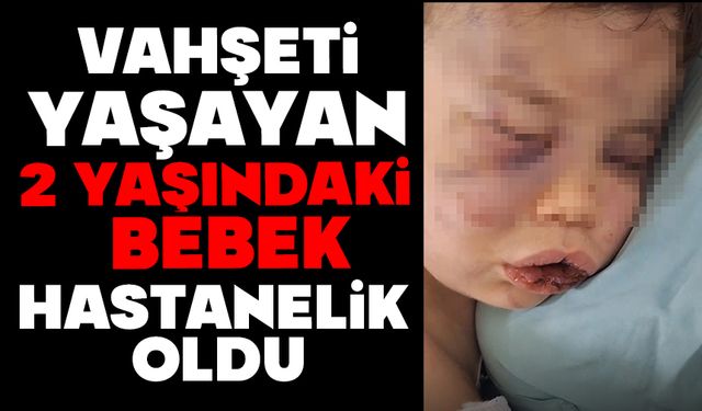 Vahşeti yaşayan 2 yaşındaki bebek hastanelik oldu