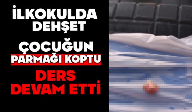 İlkokulda dehşet: Çocuğun parmağı koptu, ders devam etti