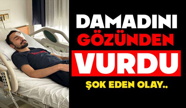 Damadını gözünden vurdu