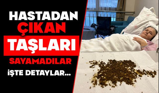 Hastadan çıkan taşları sayamadılar