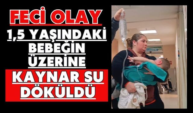 Feci olay: 1,5 yaşındaki bebeğin üzerine kaynar su döküldü
