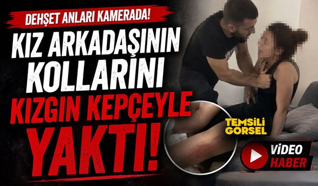 Kız arkadaşının kollarını kızgın kepçeyle yaktı