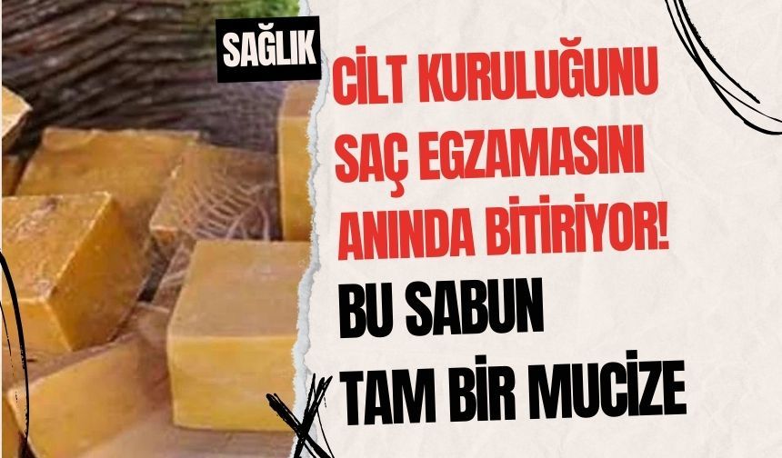 Cilt kuruluğunu, saç egzamasını anında bitiriyor! Bu sabun tam bir mucize