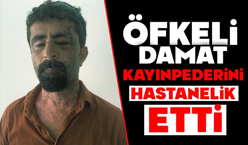 Öfkeli damat kayınpederini hastanelik etti