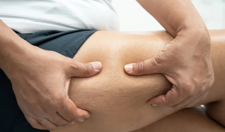 Cildinizi sıkılaştırın: Selülitle savaşan besinler