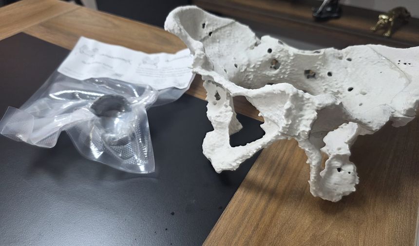 60 yaşındaki kadın 3D yazıcıyla üretilen kalça proteziyle sağlığına kavuştu
