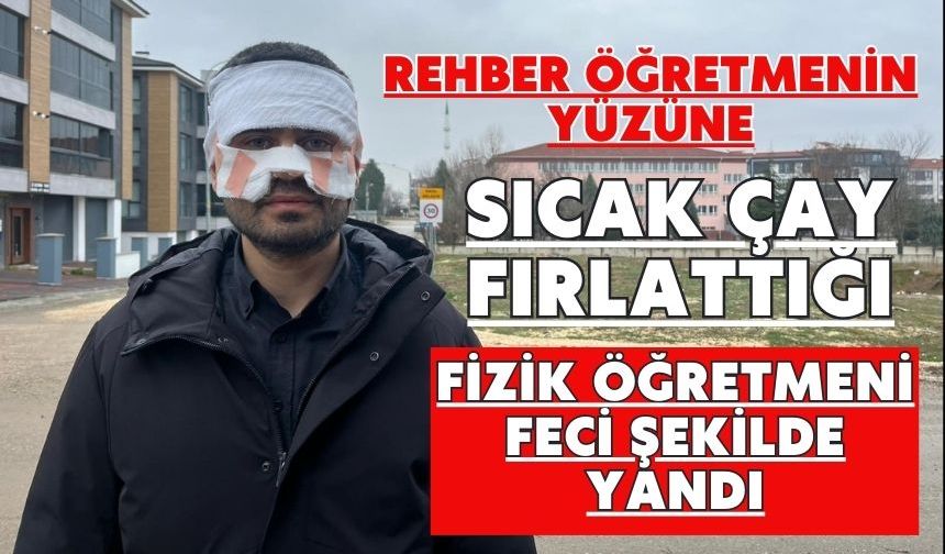 Rehber öğretmenin yüzüne sıcak çay fırlattığı fizik öğretmeni feci şekilde yandı