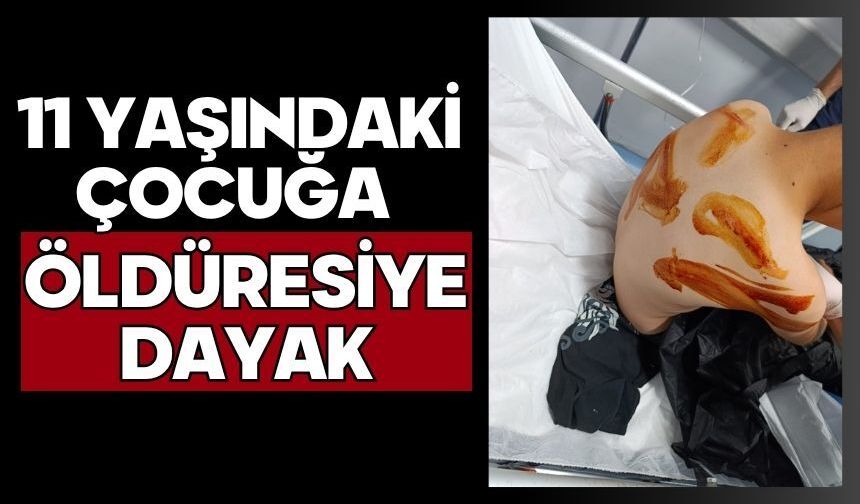 11 yaşındaki çocuğa öldüresiye dayak