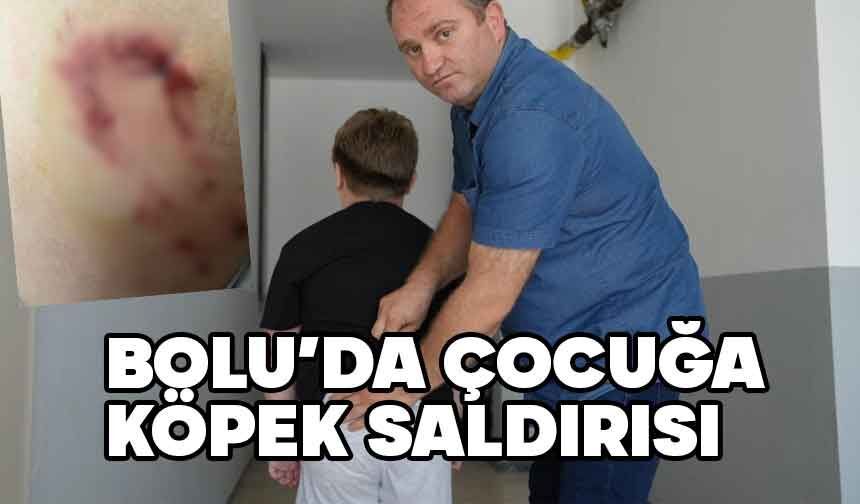 Bolu'da çocuğa köpek saldırısı