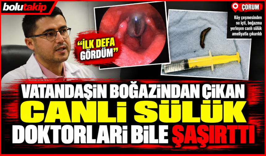 Vatandaşın boğazından çıkan canlı sülük doktorları bile şaşırttı: "İlk defa gördüm"