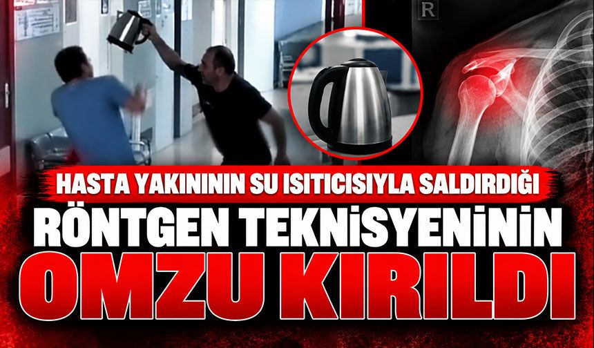 Hasta yakınının su ısıtıcısıyla saldırdığı röntgen teknisyeninin omzu kırıldı