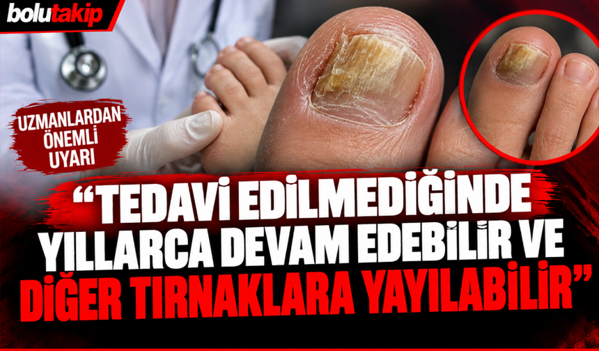"Tedavi edilmediğinde yıllarca devam edebilir ve diğer tırnaklara yayılabilir"