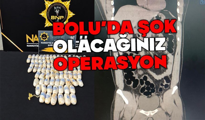 Midesinden 943 gram eroin çıktı! İran uyruklu şahıs tutuklandı