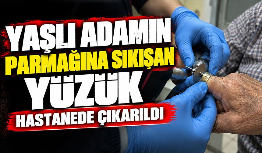 Yaşlı adamın parmağına sıkışan yüzük hastanede çıkarıldı